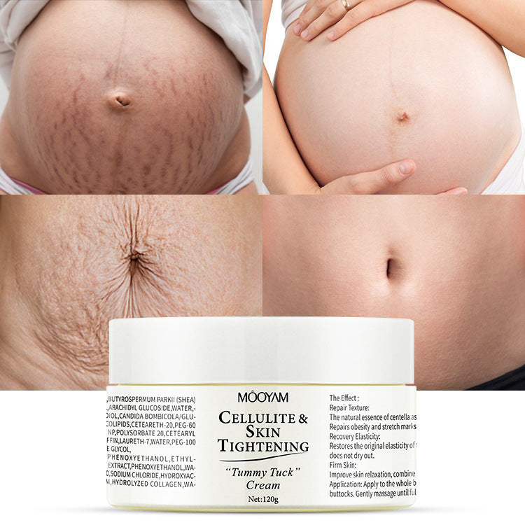 Tummy Tuck Cream – Anti-Cellulite & Skin Tightening Cream